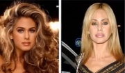 former-playboy-playmate-shauna-sands-lip-injections-have-totally-changed-the-appearance-of-her-face.jpg